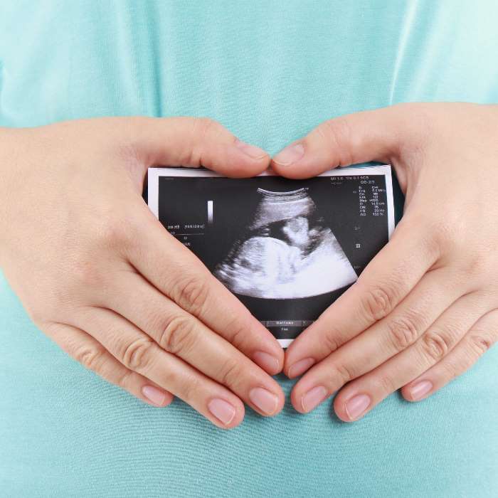 Expecting Mothers